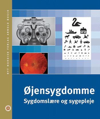 Øjensygdomme
