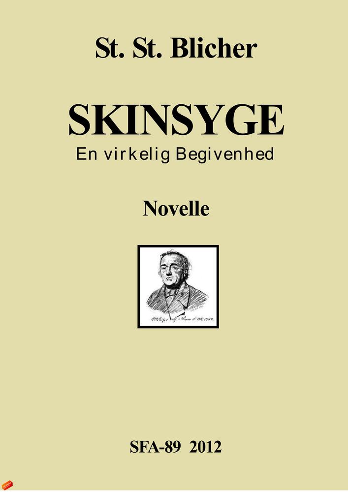 Skinsyge
