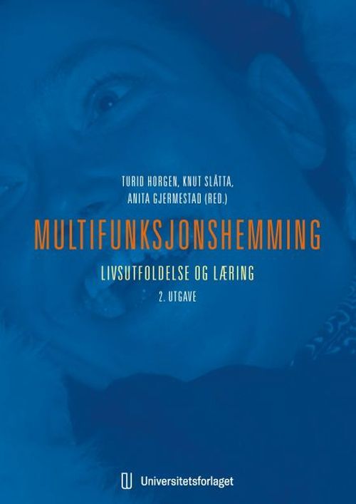 Multifunksjonshemming : livsutfoldelse og læring
