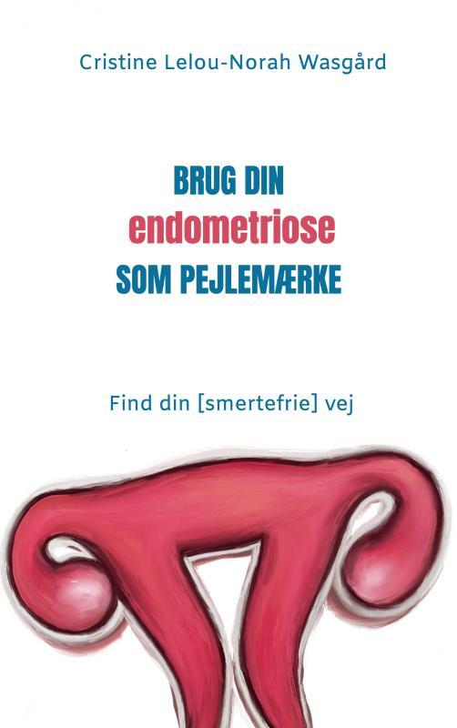 Brug din endometriose som pejlemærke
