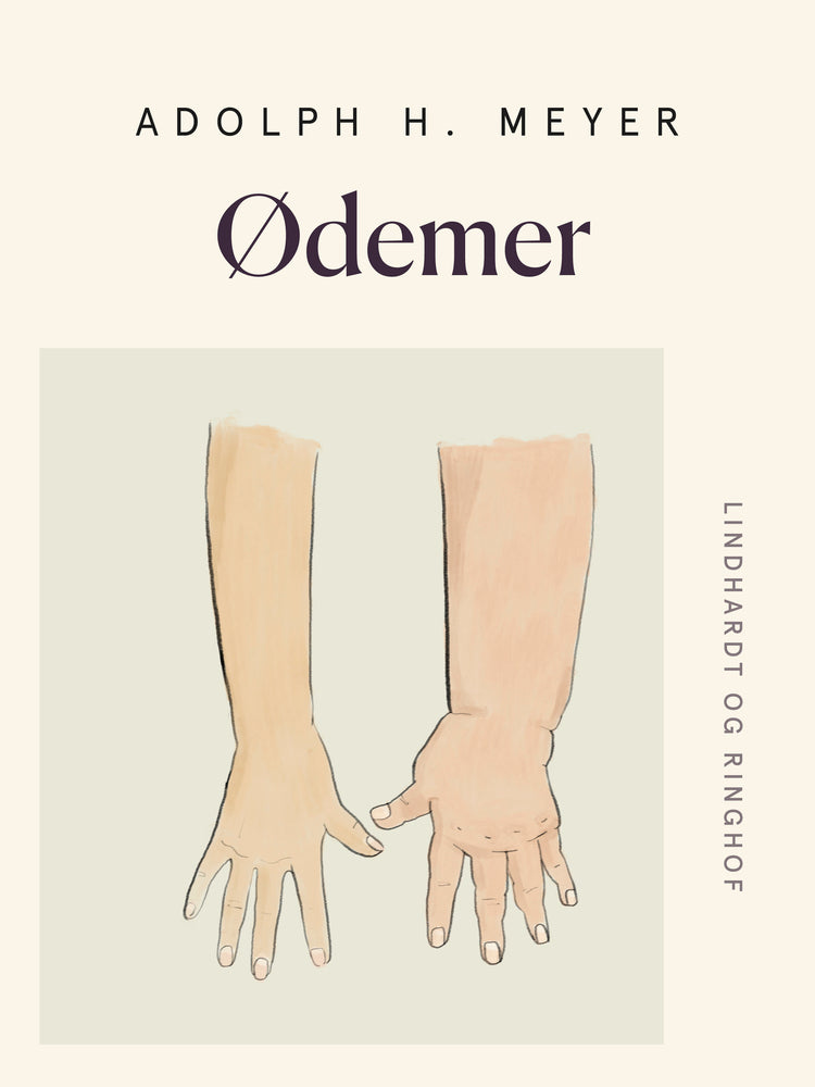 Ødemer