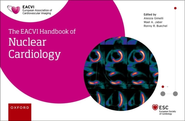The Eacvi Handbook of Nuclear Cardiology