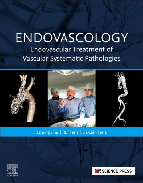 Endovascology Endovascular Treatment Of Vascular Systematic