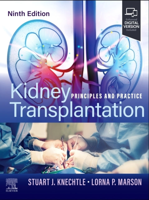 Kidney Transplantation Principles And Practice