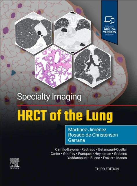 Specialty Imaging: Hrct Of The Lung