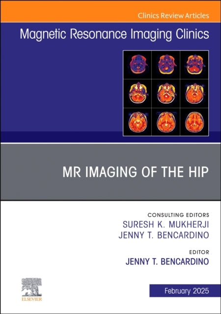 Mr Imaging of The Hip, An Issue of Magnetic Resonance Imagin