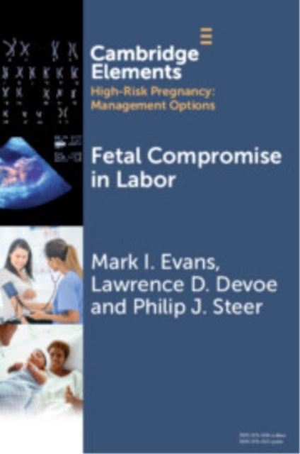 Fetal Compromise In Labor