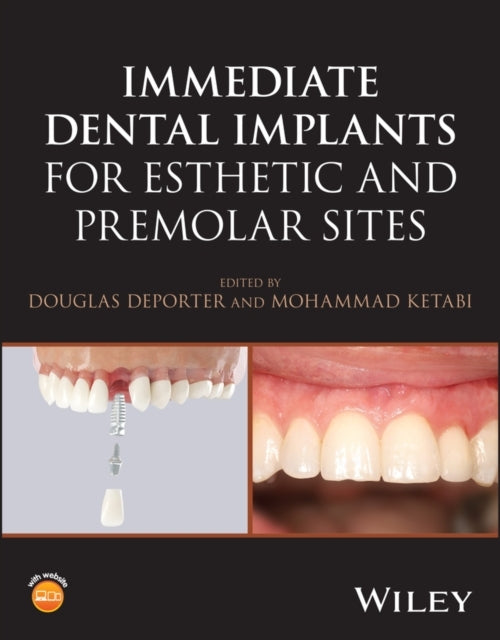 Immediate Dental Implants For Esthetic and Premola R Sites