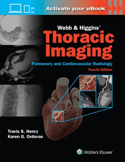 Webb & Higgins Thoracic Imaging Print + Ebook With Multimed