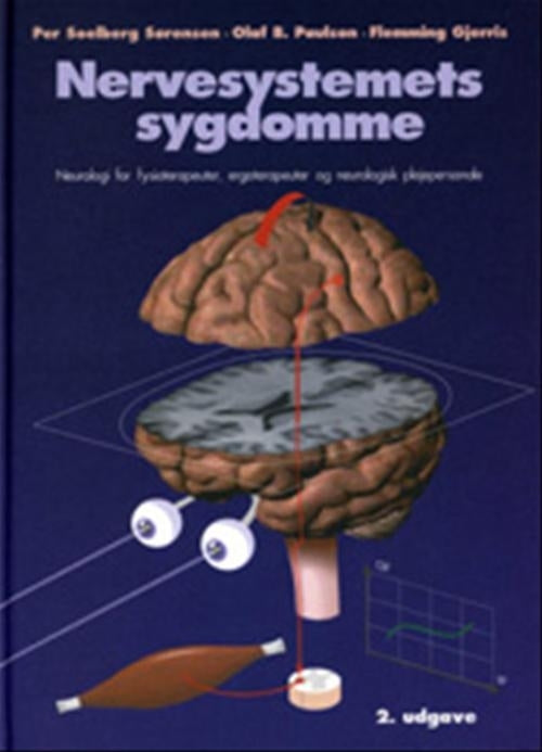 Nervesystemets sygdomme
