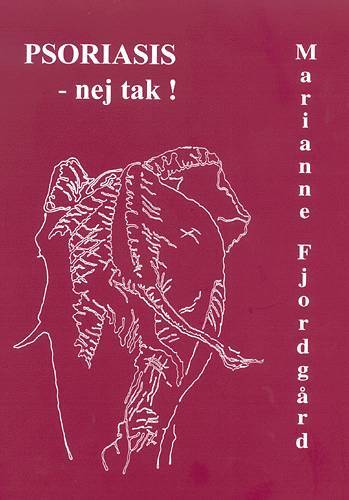 Psoriasis - nej tak!