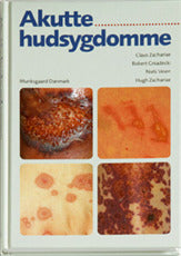 Akutte hudsygdomme