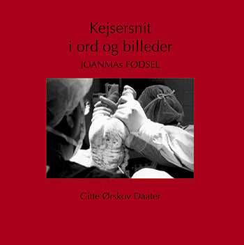 Kejsersnit i ord og billeder