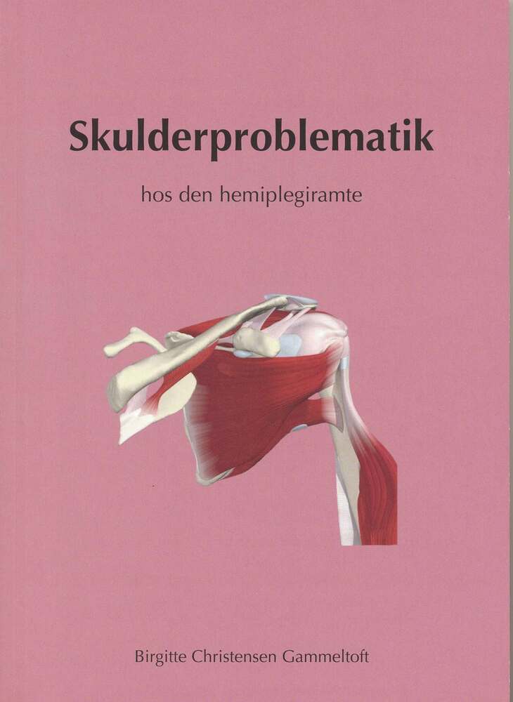 Skulderproblematik