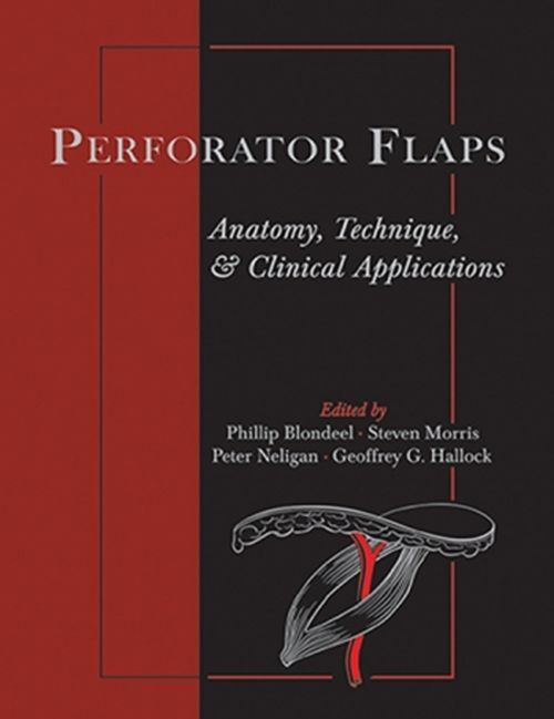 Perforator Flaps: Anatomy, Technique, & Clinical Applications, Second Edition