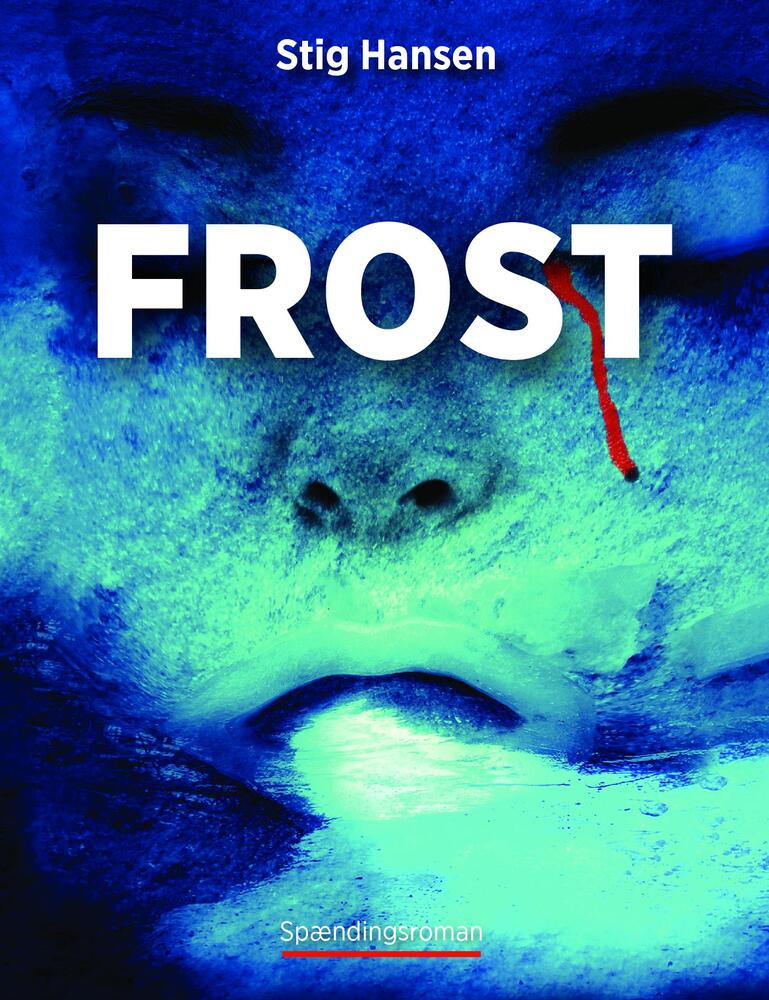 Frost