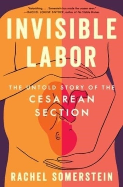 Invisible Labor The Untold Story Of The Cesarean Section