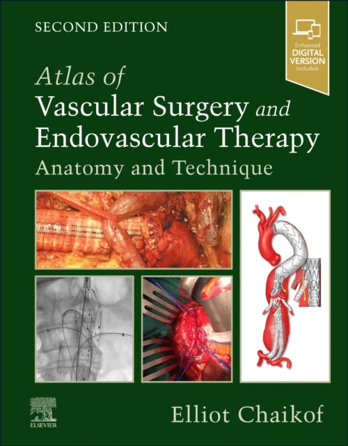 Atlas Of Vascular Surgery And Endovascular Therapy Anatomy A
