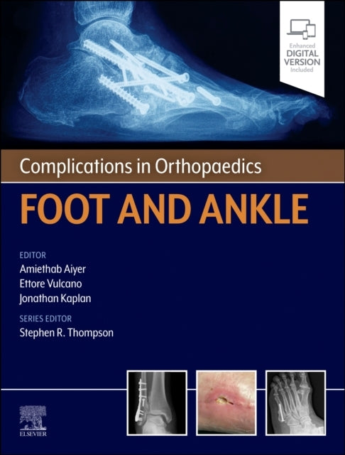 Complications In Orthopaedics: Foot And Ankle