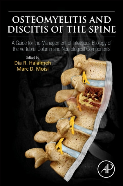 Osteomyelitis And Discitis Of The Spine A Guide For The Mana