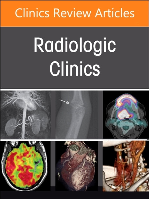Pulmonary Vascular Disease, An Issue of Radiologic Clinics O