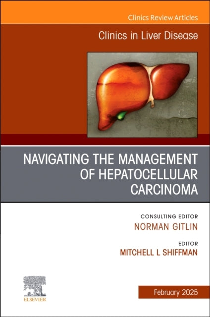 Navigating The Management of Hepatocellular Carcinoma, An Is