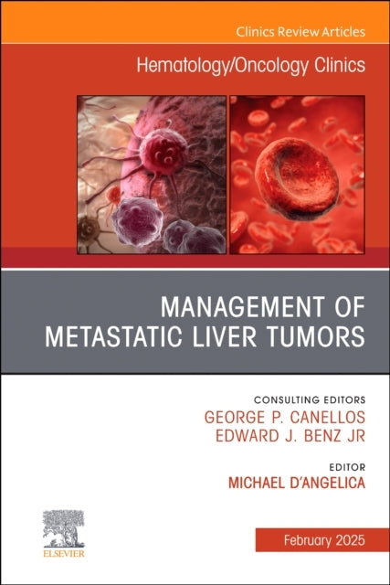 Management of Metastatic Liver Tumors, An Issue of Hematolog