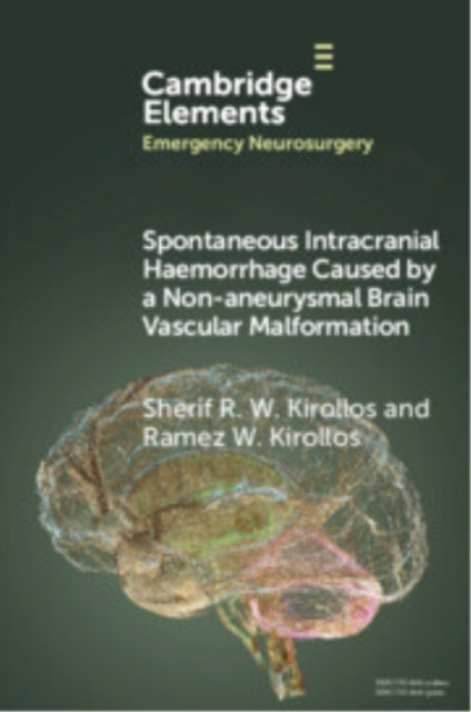 Spontaneous Intracranial Haemorrhage Caused By A Non-Aneurys