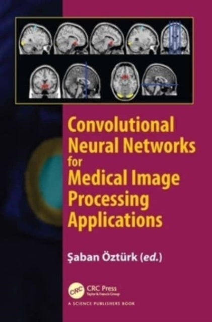 Convolutional Neural Networks For Medical Image Processing A