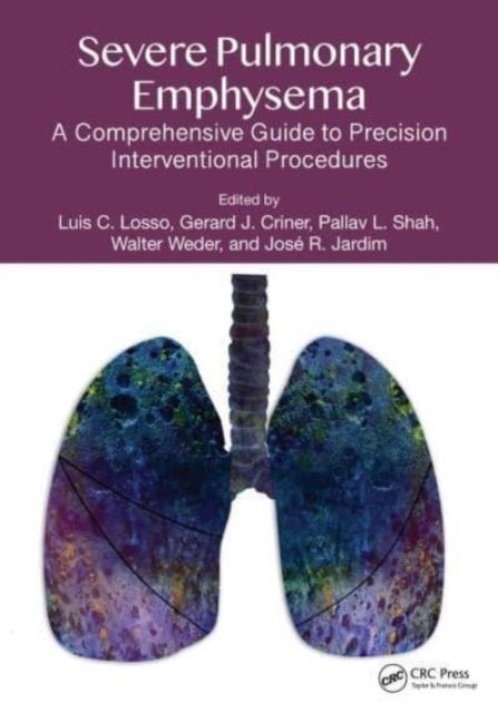 Severe Pulmonary Emphysema: A Comprehensive Guide To Precisi