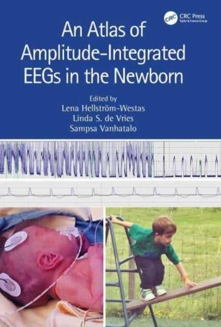 An Atlas of Amplitude-Integrated Eegs In The Newborn