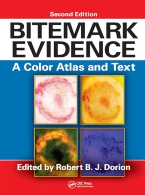 Bitemark Evidence A Color Atlas and Text, 2Nd Edition