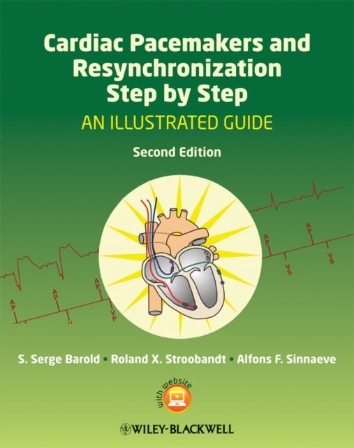 Cardiac Pacemakers and Resynchronization Step by Stepan Illu