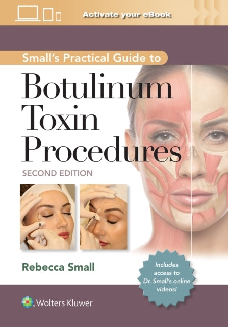 Small's Practical Guide to Botulinum Toxin Procedures: Print