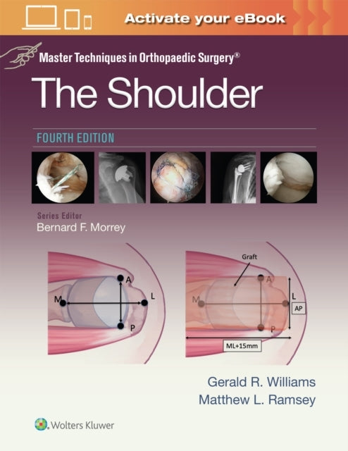 Master Techniques In Orthopaedic Surgery The Shoulder