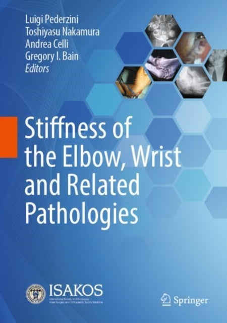Stiffness Of The Elbow Wrist And Related Pathologies