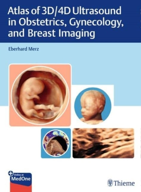 Atlas of 3D/4D Ultrasound In Obstetrics Gynecology and Bre